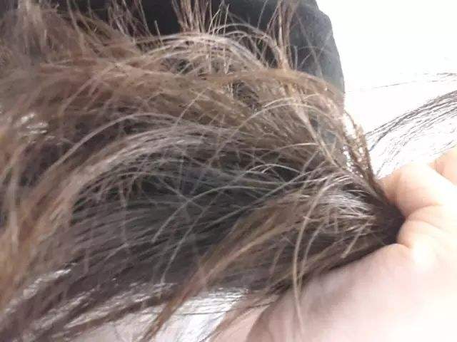 头发分叉应该怎么护理？