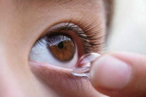 ok镜适合什么人戴