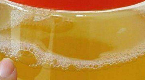 男人1到2个小时尿一次正常吗