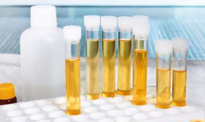 半天不喝水小便颜色太深正常吗？