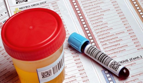 长时间不喝水尿是什么颜色