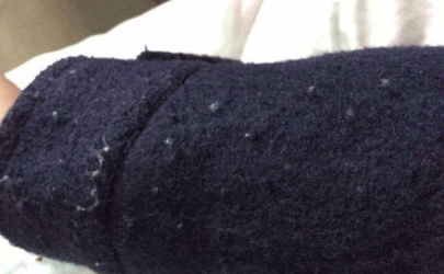 衣服为什么会起球？衣服爱起球怎么办