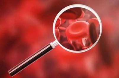 貧血是什么原因造成的