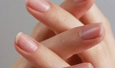 指甲上有凹陷小坑怎么原因